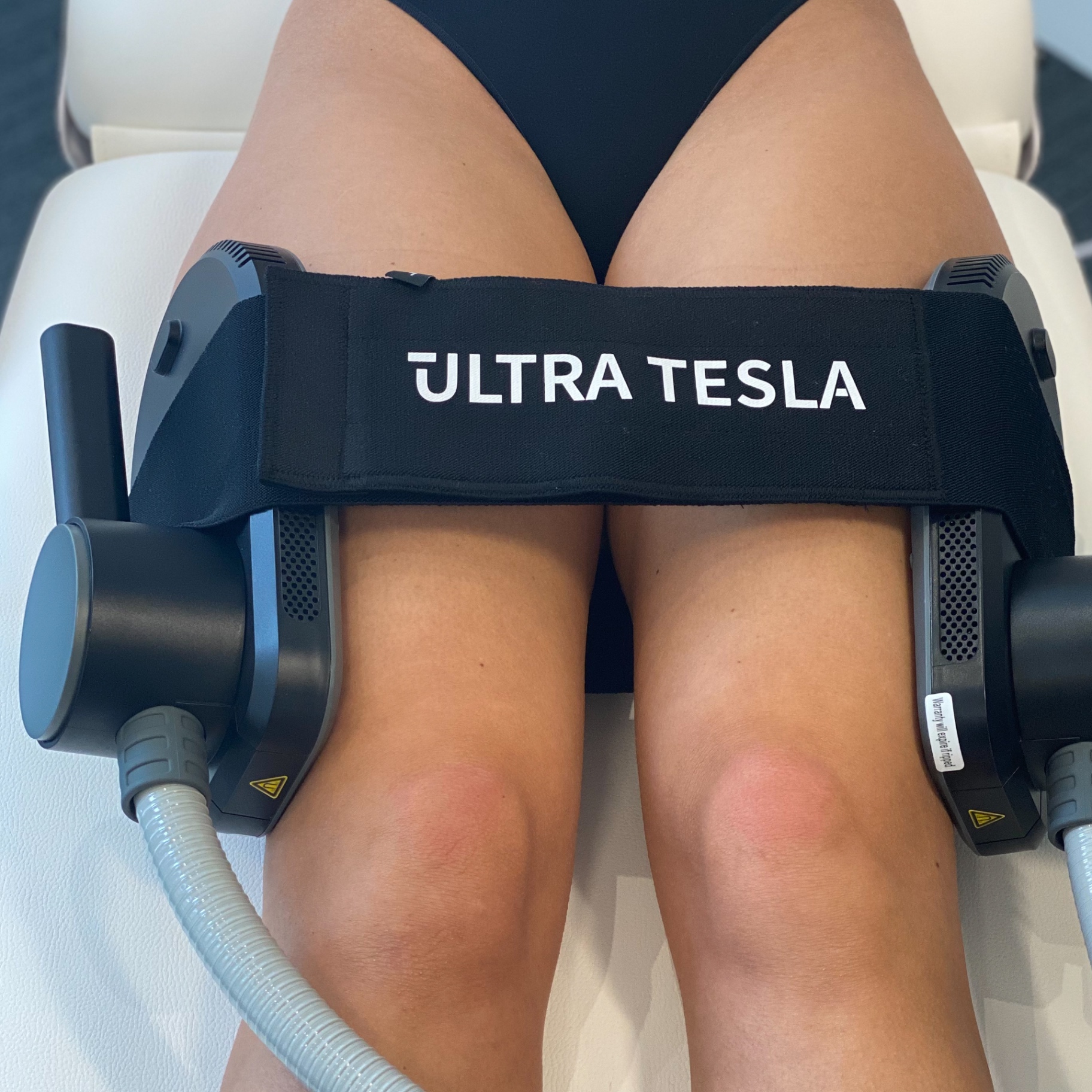 Ultra Tesla body sculpting treatment on the thighs